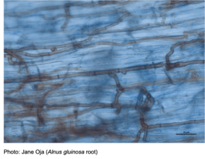 Mörka septatendofyter inuti trädrötter i mikroskop. Foto: Jane Oja