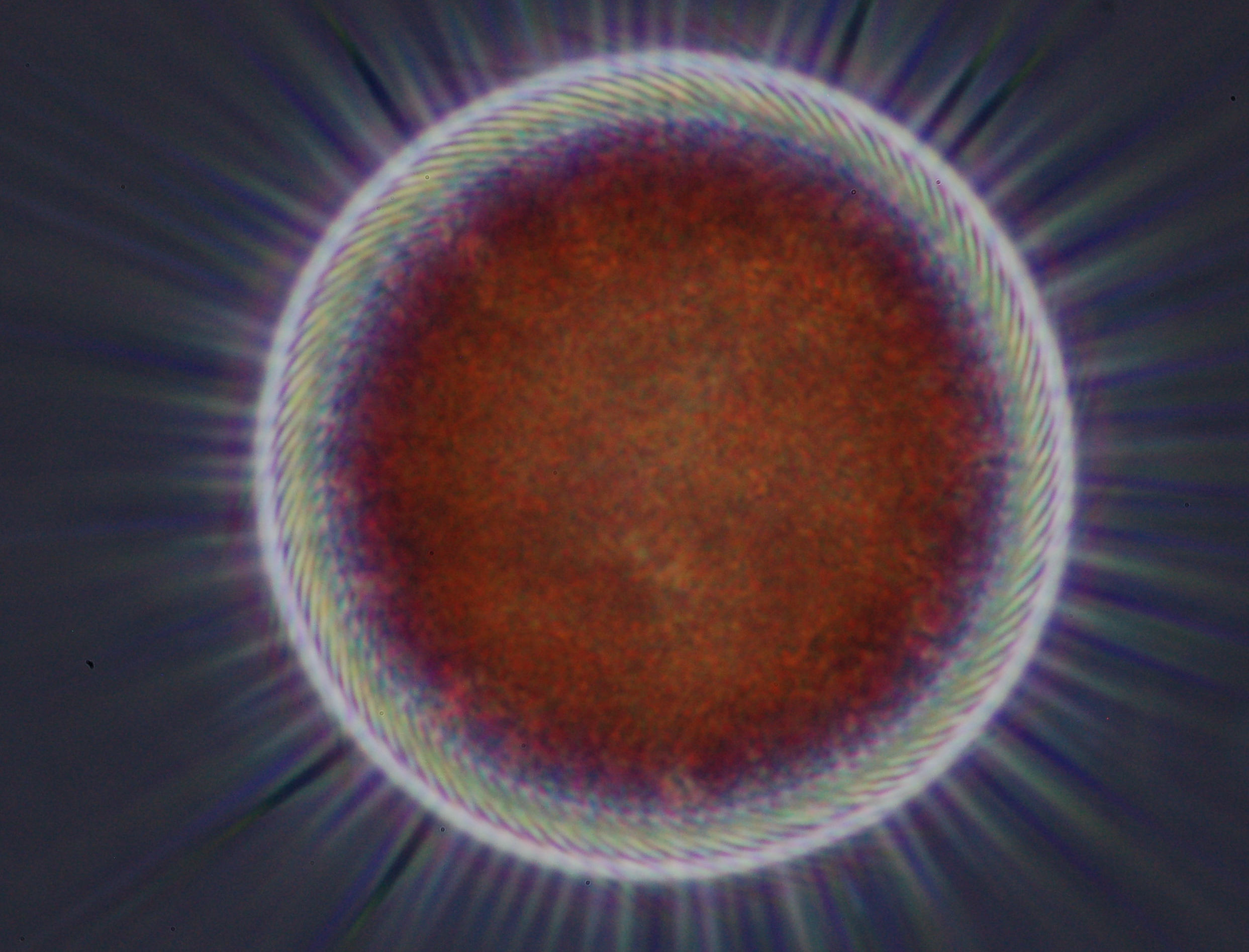 Mesodinium. Naturen är fylld av mönster och upprepningar, likaså i algernas värld. Här finns diamantformationer, cirklar och kvadrater. Foto: Tore Lindholm
